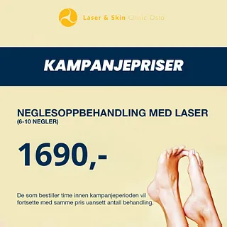 Neglesoppbehandling
